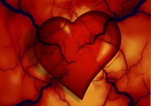 infarto
