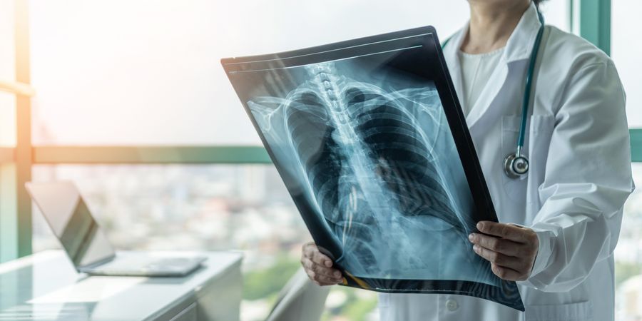Quante radiografie si possono fare in anno - Linea